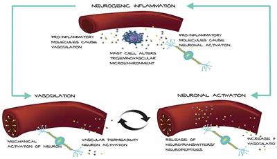 Vascular Contributions to Migraine: Time to Revisit?